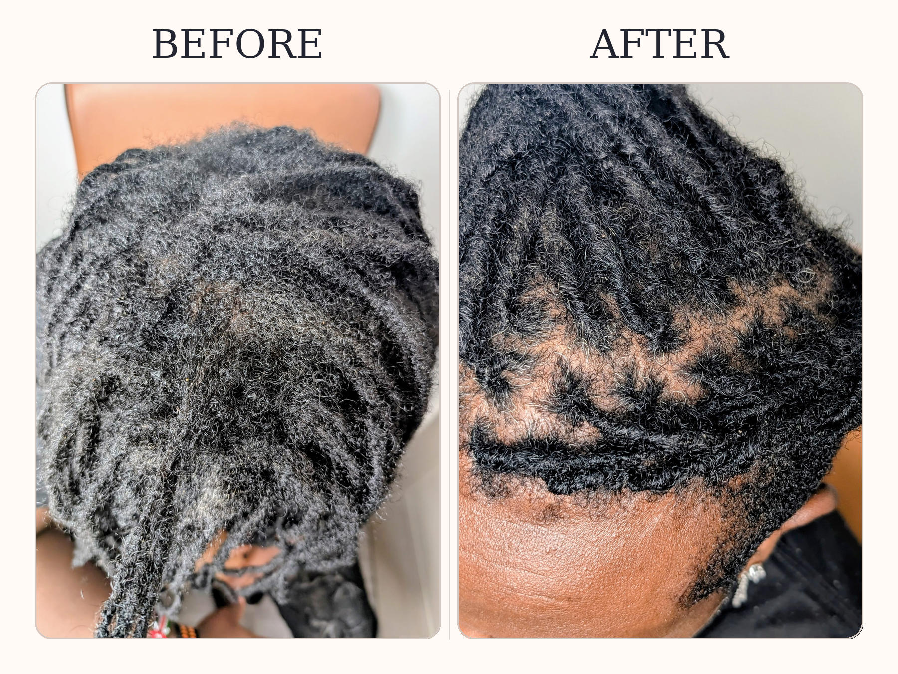 Before-and-after collage showing loc regrowth before maintenance and neat retightened roots afterwards